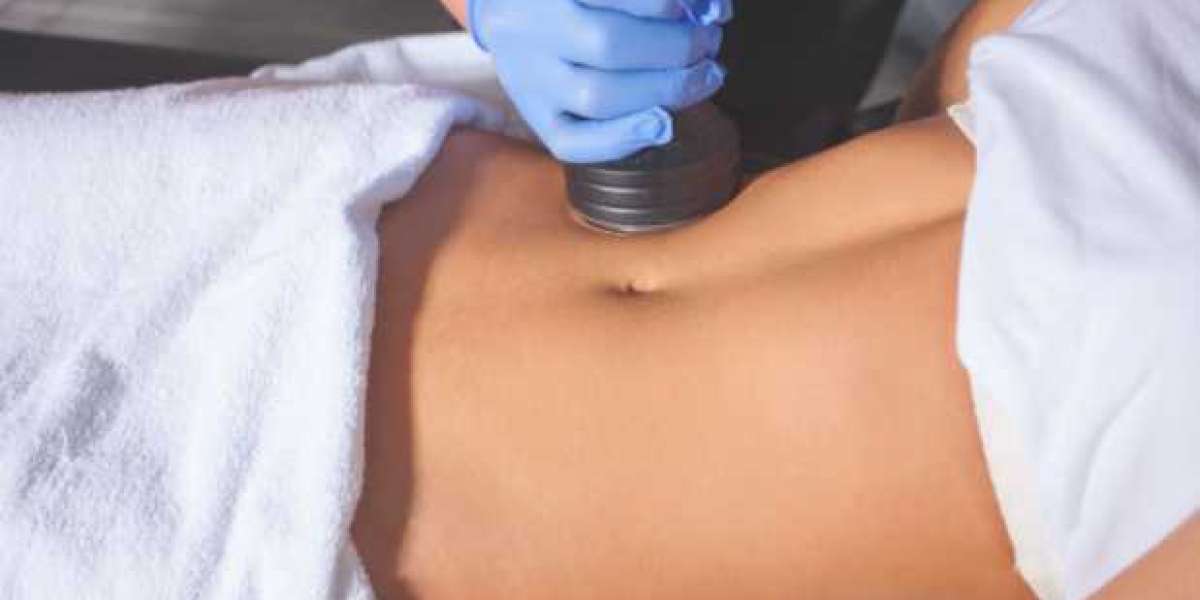 Beverly Hills Coolsculpting