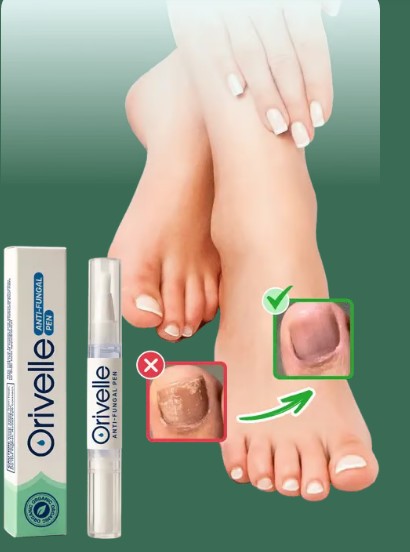 Orivelle Anti Fungal Pen